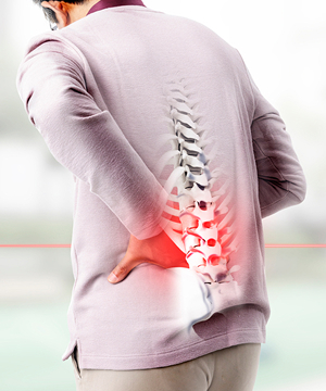 척추관협착증 예시 사진